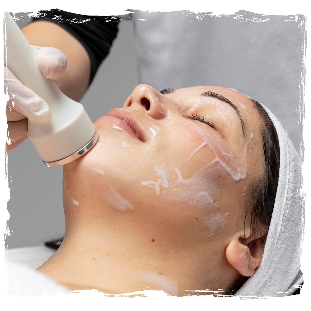 Kimyasal Peeling Nedir? 